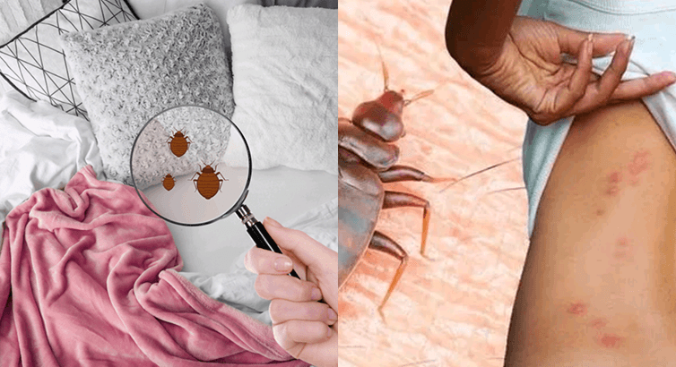 Best Bed Bugs Control in Dubai – Book Now!